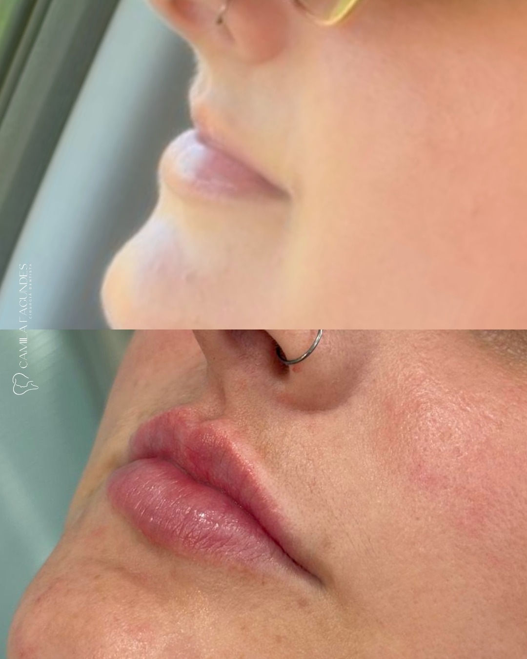 dra_camilafagundes__2026-01-30T174206.000Z